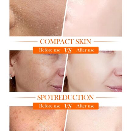 Sadoer 5x Vitamin C Skin Active whitening Cream | Vitamin C Hydrating Face Cream - Glowing & Repairing Moisturizer for Fine Lines, Wrinkles & Uneven Skin Tone | Whitening Cream