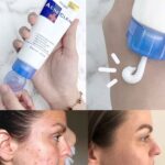 Mistine Acne Clear Face Wash Facial Foam 85 ml - Image 3