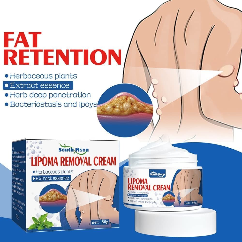 b0962c0a667fe4d197943faab145e262.jpg South Moon Lipoma Removal And Body Smoothing Cream 50g Herbal Natural Lump And Skin Knot Relief Ointment - Image 1